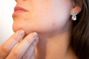 كورس Skin care