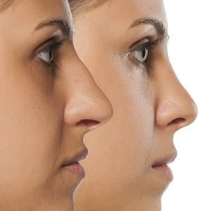 دراسة تخصص طب التجميل للأطباء والصيادلة | أكاديمية challenge