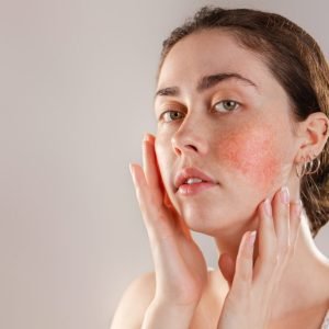 العناية بالبشرة الحساسة | كورس skin care بخصم 50%