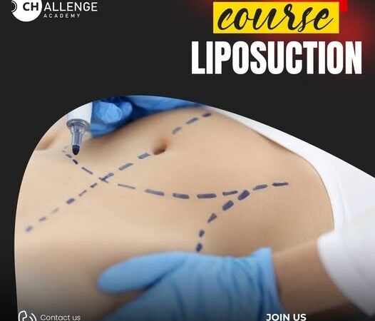 كورس شفط الدهون Liposuction Course