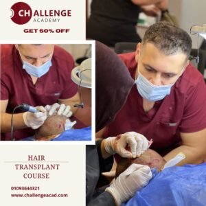 Hair Transplant 15/10/2026